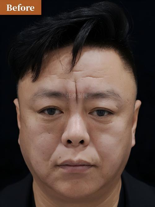 医保24小时在线套医保微信能用吗怎么弄？官方解答来了